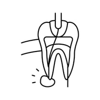 Root Canal Treatment